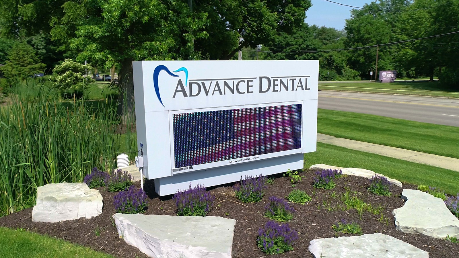 Cracked tooth treatment at Advance Dental, Grand Rapids MI